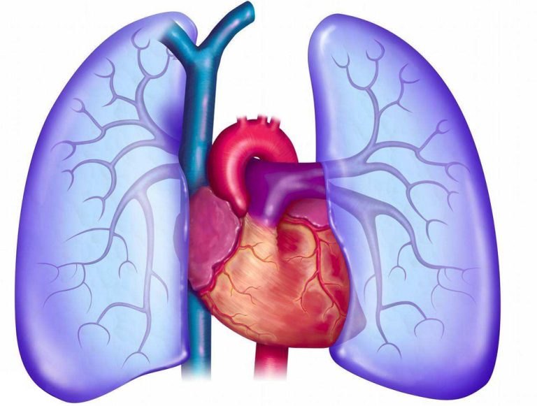 Merck's Pulmonary Arterial Hypertension Drug Sotatercept Phase III ...